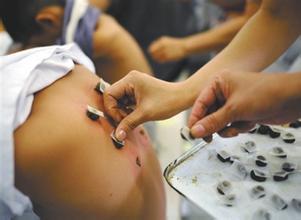 中医贴灸产品起名技巧