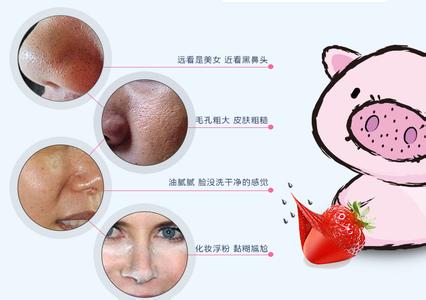 鼻贴膜品牌起名及名字大全